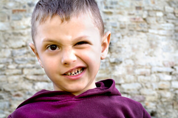 Portrait of a boy who is crooked
