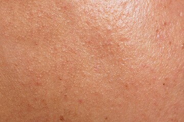 Fototapeta premium Human skin texture