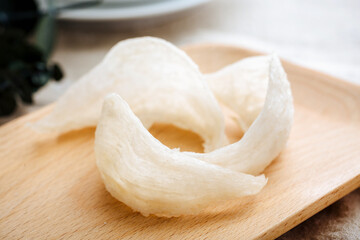 Bird's Nest