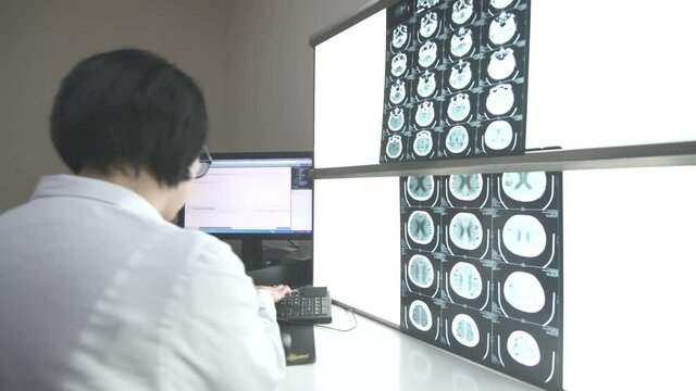 Middle aged female radiologist in white uniform sits at computer and type on the keyboard diagnosis while examines  x-rays on the light board, steady cam shot, real scene