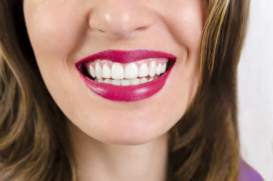 Woman with perfect teeth, closeup, focus on mouth, shallow depth of field 