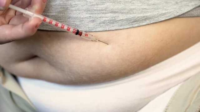 Close up of overweight female injecting insulin into the stomach, diabetes