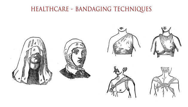 Head and chest bandaging techniques