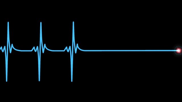 Herzstillstand Herzinfakt Tod EKG