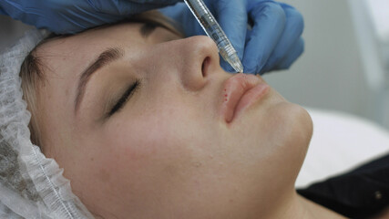 Injections of hyaluronic acid in the lips in the beauty salon
