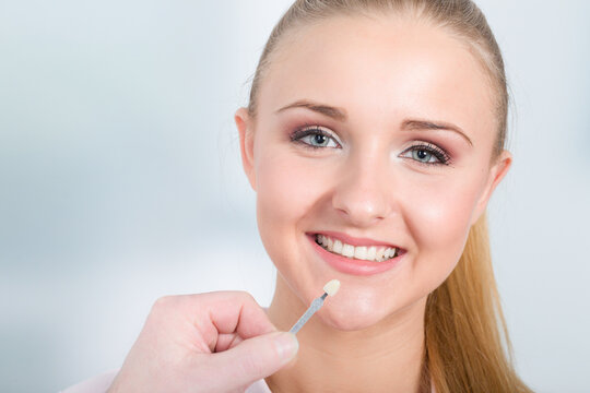 Farbabgleich am Zahn für einen Zahnersatz am Mund einer jungen hübschen Frau