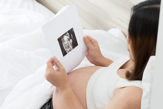 Pregnant woman holding ultrasound image and medical documents at home