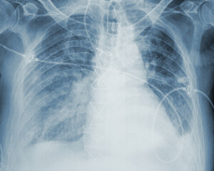Image of an X-ray analysis