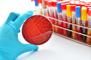 Colonies of bacteria in blood agar (culture medium plate)
