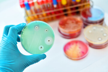 Antimicrobial susceptibility testing in petri dish