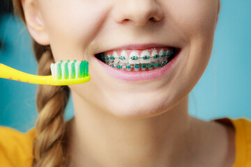 Woman with teeth braces using brush - obrazy, fototapety, plakaty