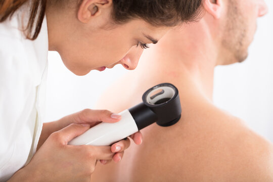 Doctor Using Dermatoscope For Skin Examination