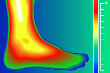 Human Leg. Infrared Thermograph with temperature scale. Infrared energy scan Actual temperature.