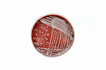 Colonies of bacteria in petri dish (Chocolate agar)
