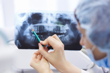 Doctor talking with patient and showing a radiograph in stomatology clinic
