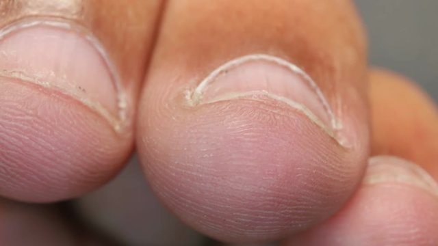 Close up of Human Skin Texture 
