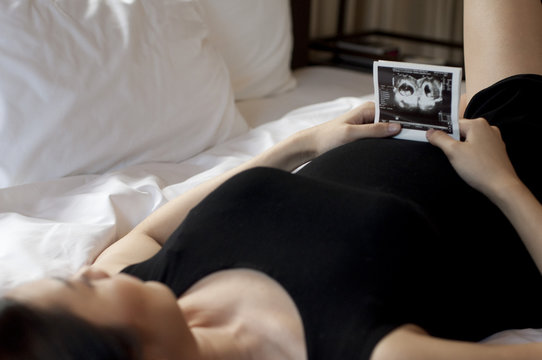 A pregnant woman wearing a black dress is holding a sonogram
