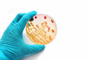Colonies of bacteria in petri dish (MacConkey agar)
