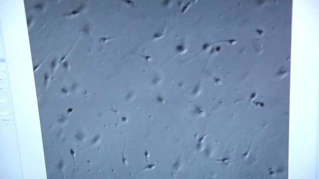 Close-up, sperm under magnification.