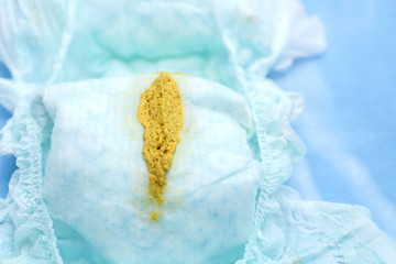 Feces baby 5 months healthy in diapers