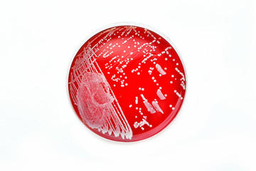 Colonies of bacteria in petri dish
