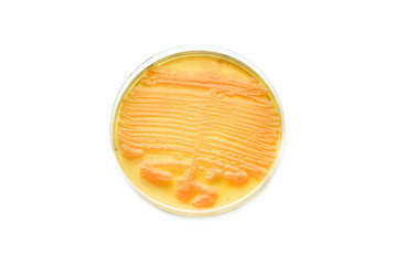 Colonies of bacteria in petri dish
