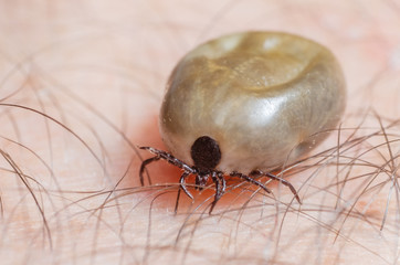 Tick filled with blood sitting on human skin