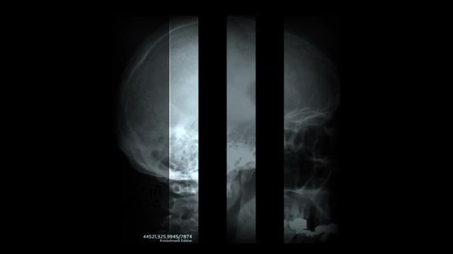 4k Human bones scan,medical scanning,abstract X-ray scientific research,body health bones Pet-CT big-data,genes explore,horror murder criminal cases,danger radiation death,terror suspense crime corpse