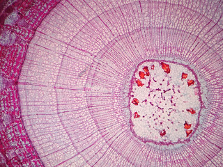 Cross sections of  plant stem under microscope view