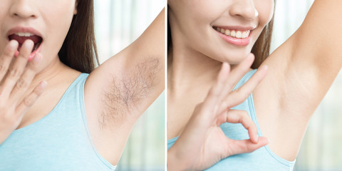 woman with armpit plucking