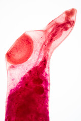 parasite on slide under microscope view.