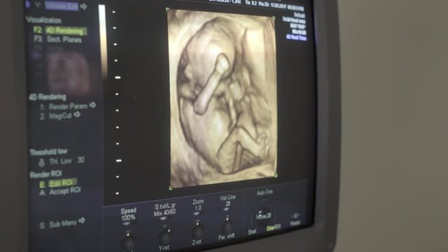 A Child Is Seen Using By Ultrasound Equipment