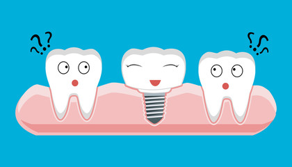 Human teeth and Dental implant. Stock vector illustration.