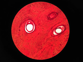 Histology of human compact bone tissue under microscope view