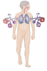 Depiction of a healthy bronchial tube (left) and a bronchial tube during an asthma attack (right)