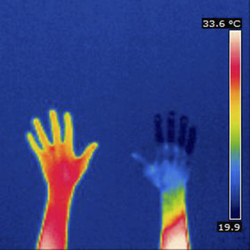 Thermogram