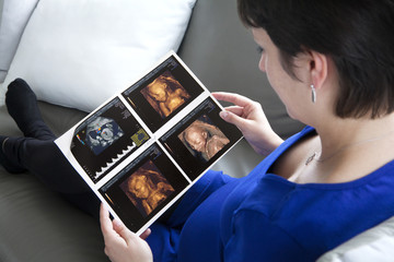 6 months pregnant woman, holding her second term scan
