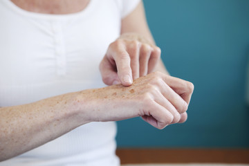 Dermatology, symptomatology elderly person