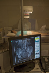 Centre de Radiologie et d'Imagerie M￩dicale ￠ Paris Examen radiologique
