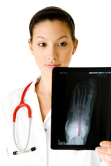 Model X-ray of a foot (without pathology)
