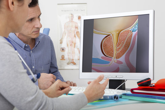 Models On screen, drawing illustrating the prostate (without pathology)