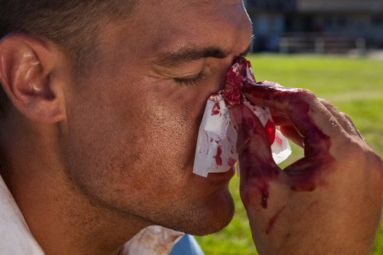 Close Up Of Rugby Player With Injured Nose