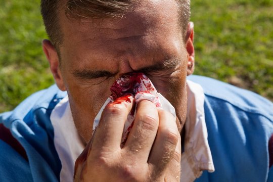 High angle view of rugby player with injured nose - Powered by Adobe