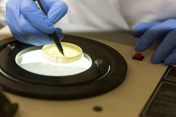 Scientist at work with colony counter