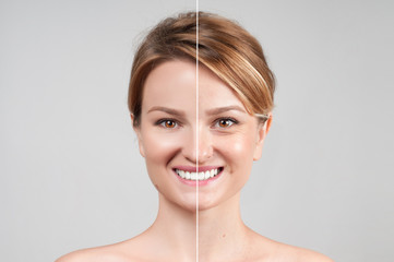 Woman before and after cosmetic or plastic procedure