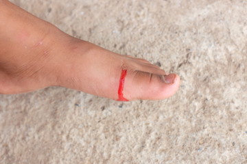 Blood from child's foot caused by the accident.