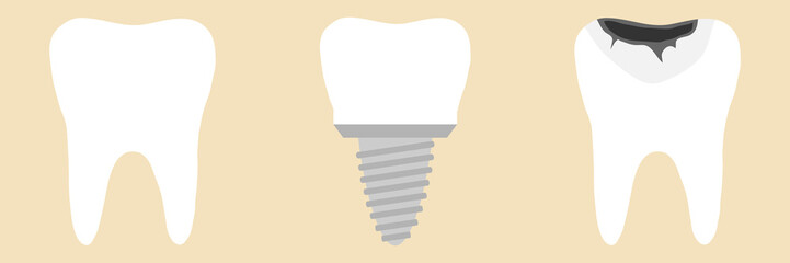 Tooth, tooth implant