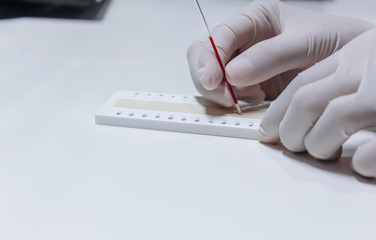 blood sample for hematocrit testing on white background