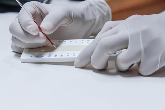 blood sample for hematocrit testing on white background