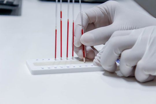 blood sample for hematocrit testing on white background